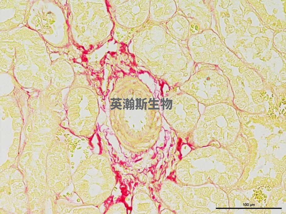 天狼星紅.jpg
