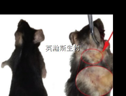 系統性紅斑狼瘡_wm.jpg