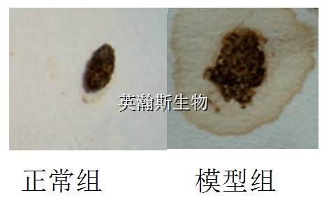 腹瀉模型_wm.jpg