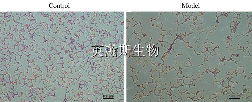 1646370462172714.jpg 肺氣腫模型_wm.jpg