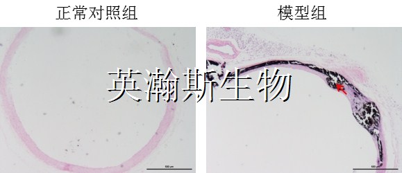血管鈣化模型_wm.jpg