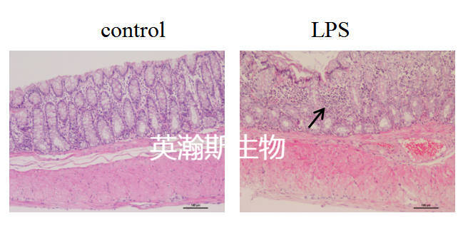 膿毒癥.jpg
