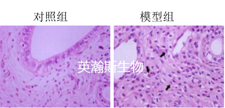 輸卵管炎模型.png