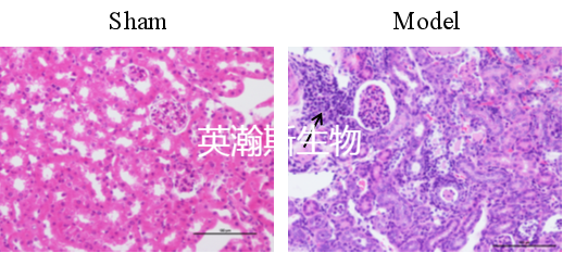 腎盂腎炎 (1).png