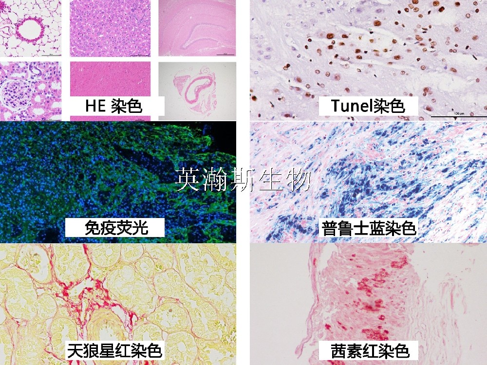 病理圖片拼貼_wm.jpg